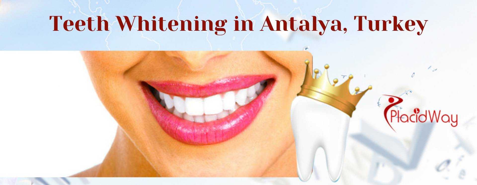 Teeth Whitening in Antalya, Turkey
